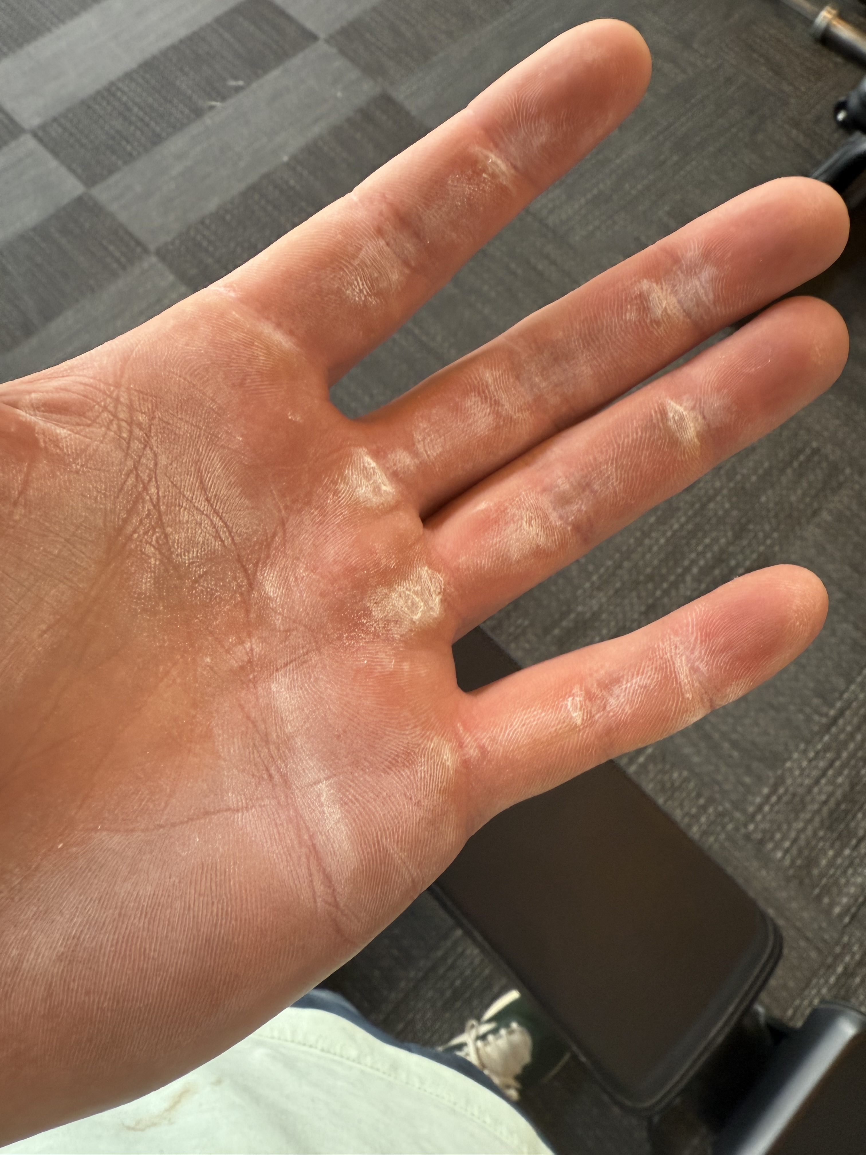 hands